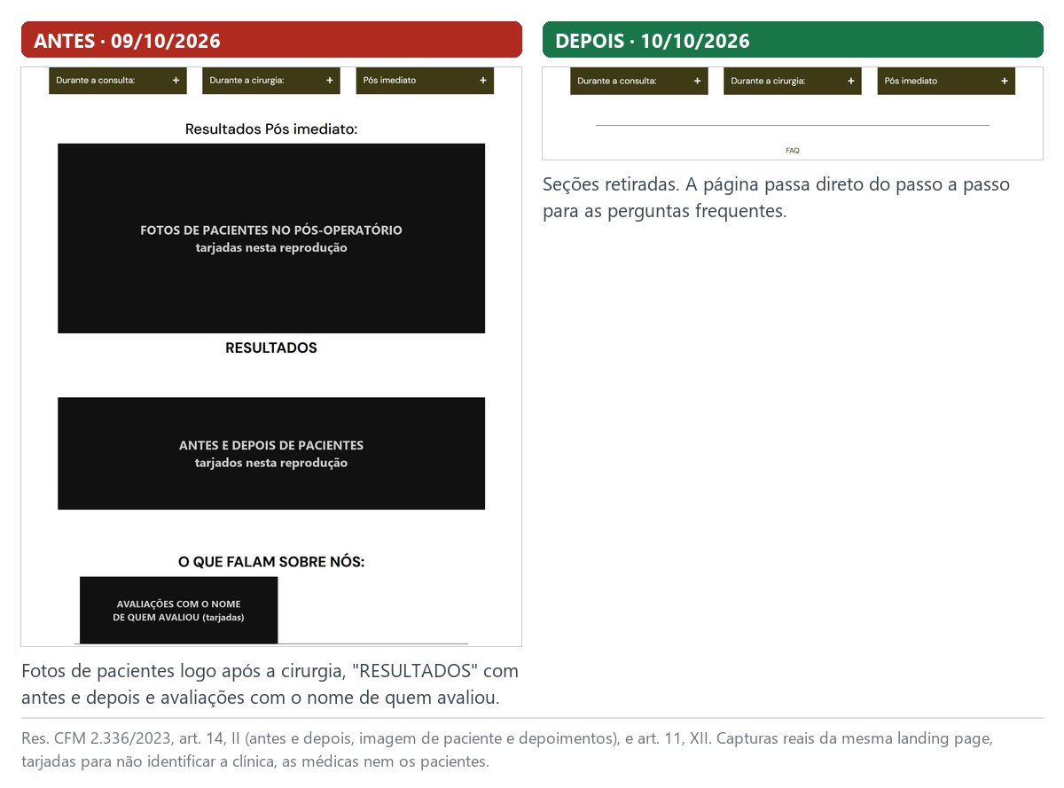 Seções de resultados e depoimentos antes e depois: fotos de pacientes no pós-operatório, antes e depois e avaliações tarjados no antes e seções retiradas no depois