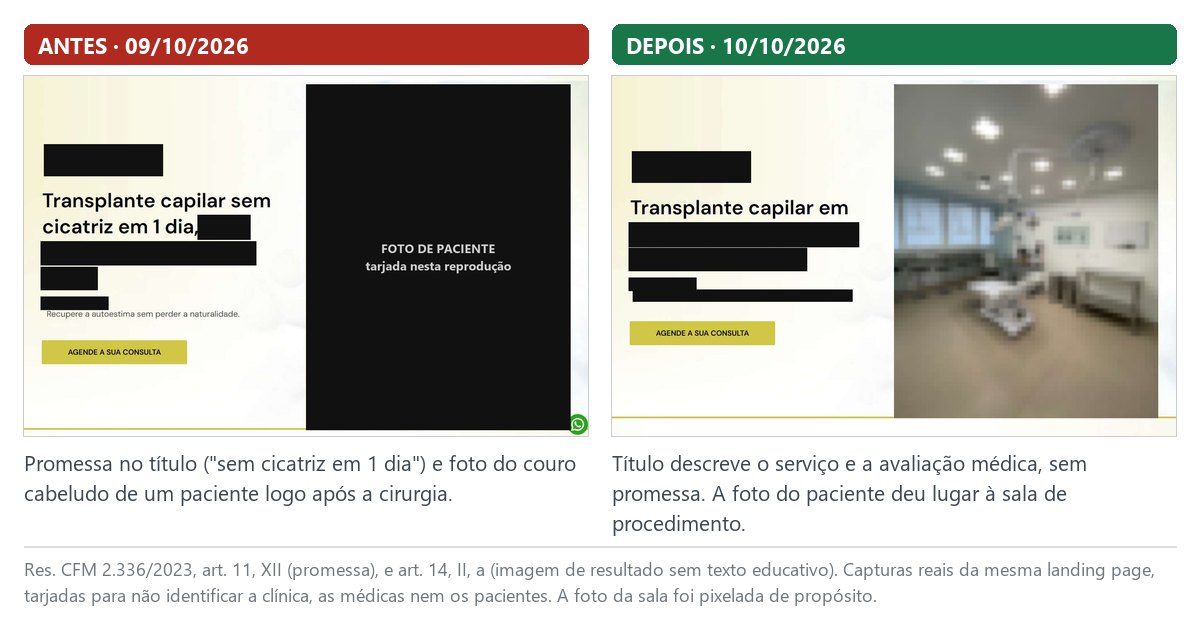 Topo de landing page antes e depois da adequação ao CFM, com o título que prometia resultado e a foto de paciente tarjada